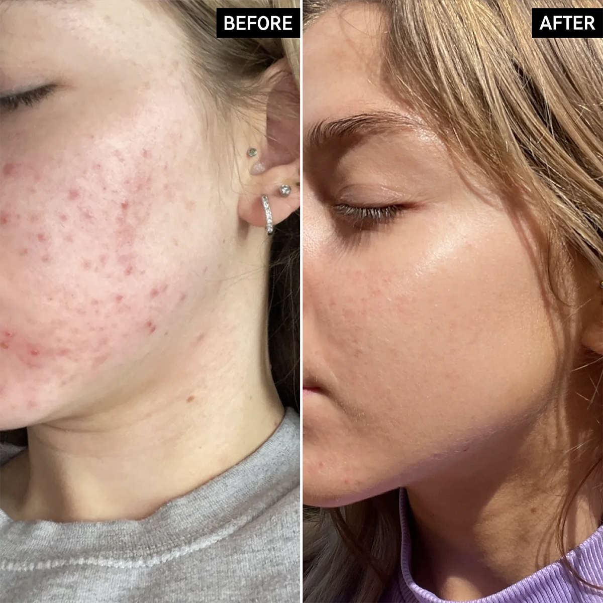 The INKEY List - Beta Hydroxy Acid (BHA) Serum Fantastic Look Albania Tirana
