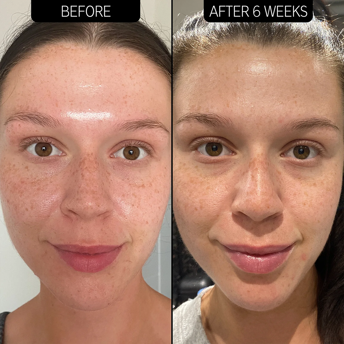 The INKEY List - 20% Niacinamide Serum Fantastic Look Albania Tirana