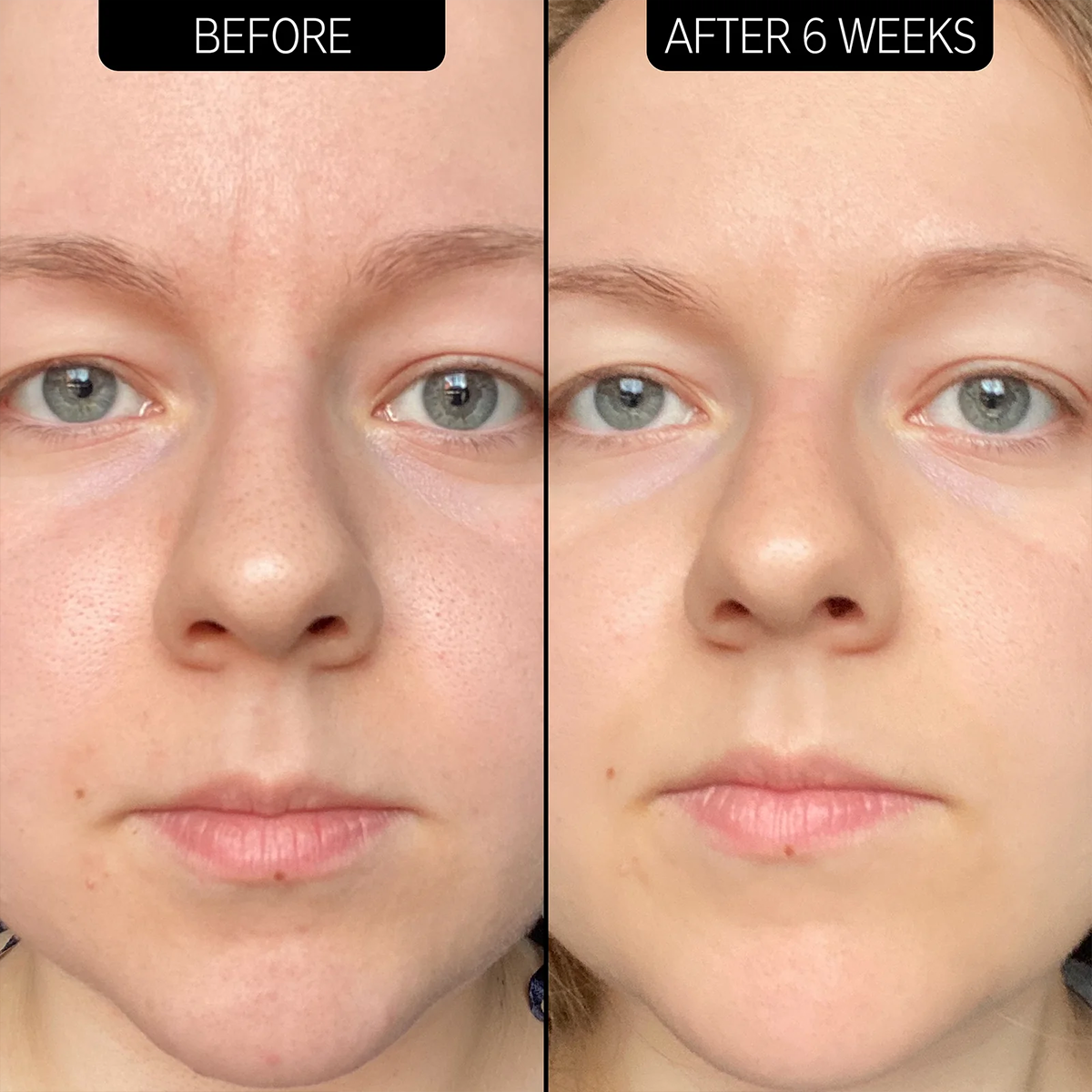 The INKEY List - 20% Niacinamide Serum Fantastic Look Albania Tirana