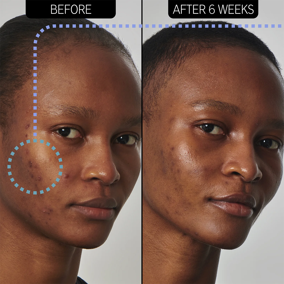 The INKEY List - 20% Niacinamide Serum Fantastic Look Albania Tirana