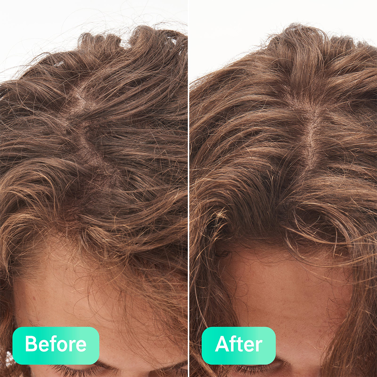 The INKEY List - Glycolic Acid Exfoliating Scalp Scrub Fantastic Look Albania Tirana