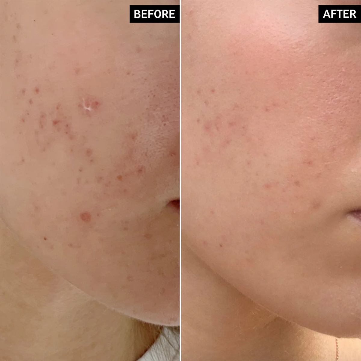 The INKEY List - Mandelic Acid Treatment Fantastic Look Albania Tirana