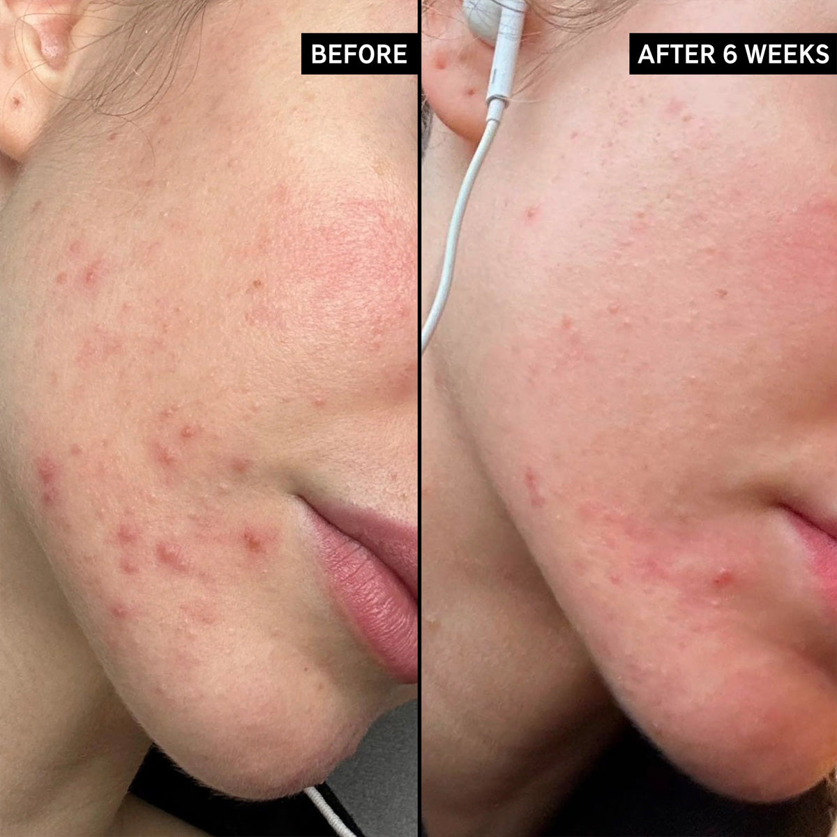 The INKEY List - Blemish Clearing Moisturiser    Fantastic Look Albania Tirana