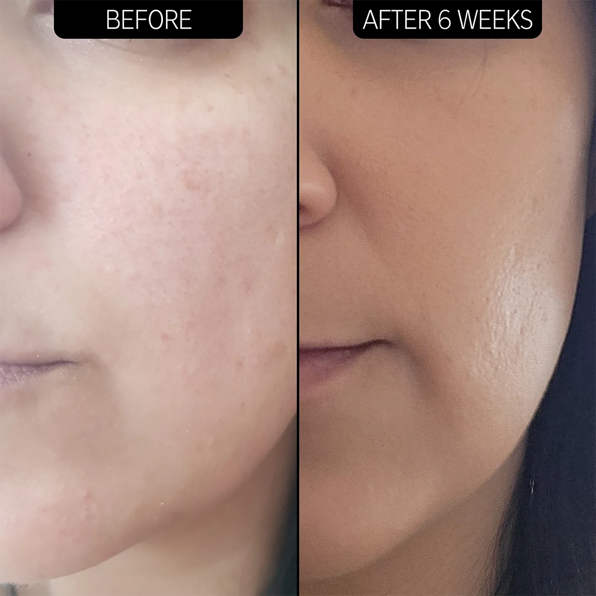 The INKEY List - 10% Urea Moisturizer    Fantastic Look Albania Tirana
