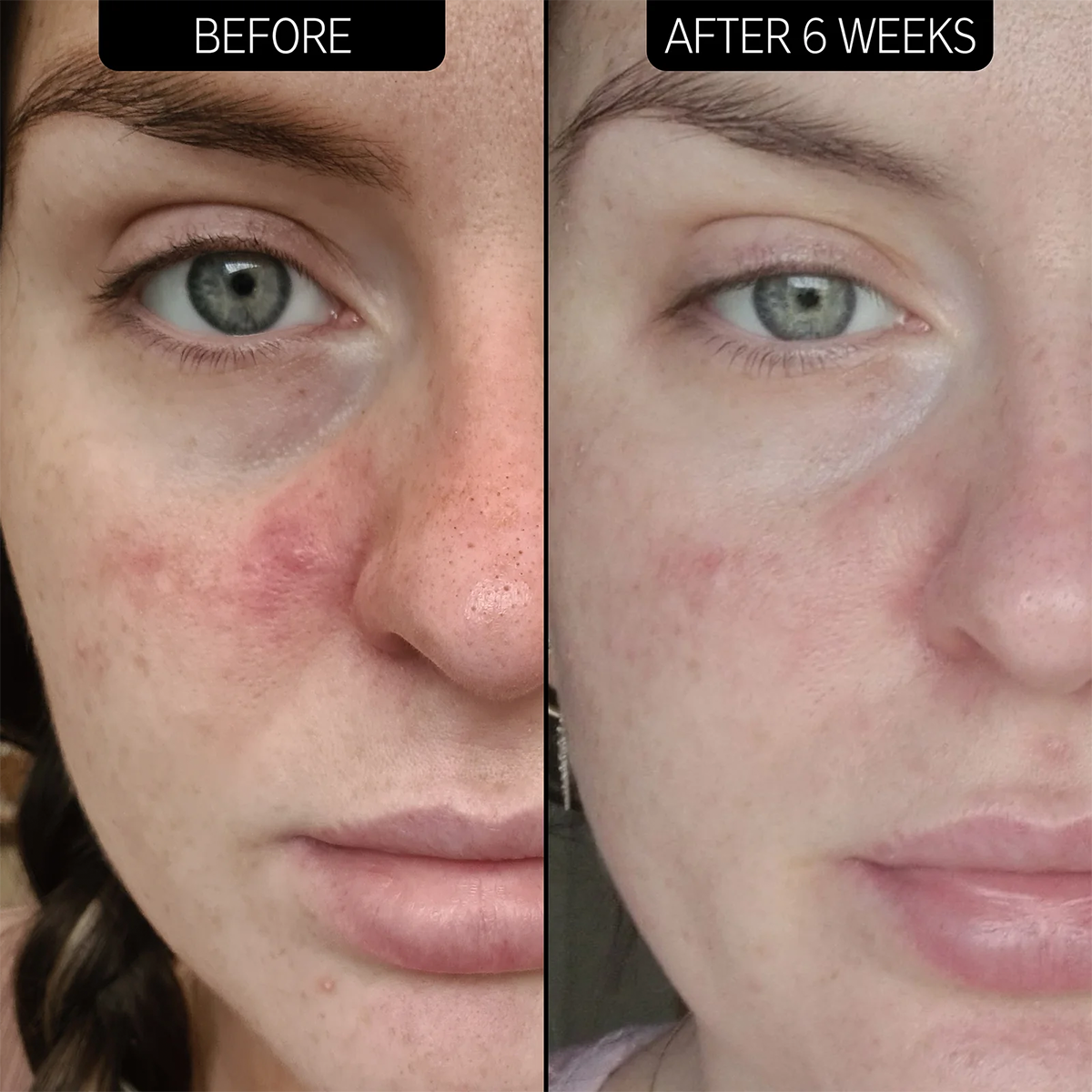 The INKEY List - 10% Azelaic Acid Serum    Fantastic Look Albania Tirana